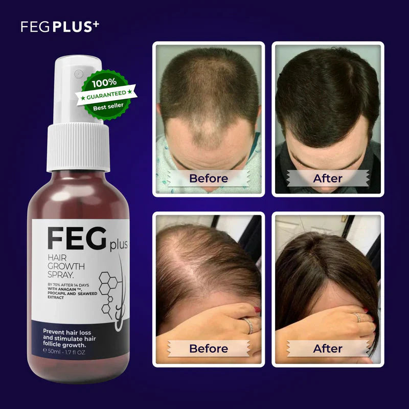 FEG Plus Hair Growth Spray (Buy 1 Get 1 Free)