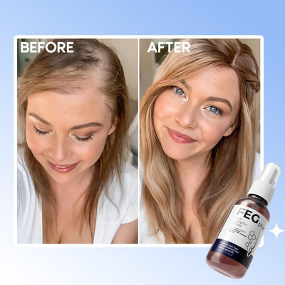 FEG Plus Hair Growth Spray (Buy 1 Get 1 Free)