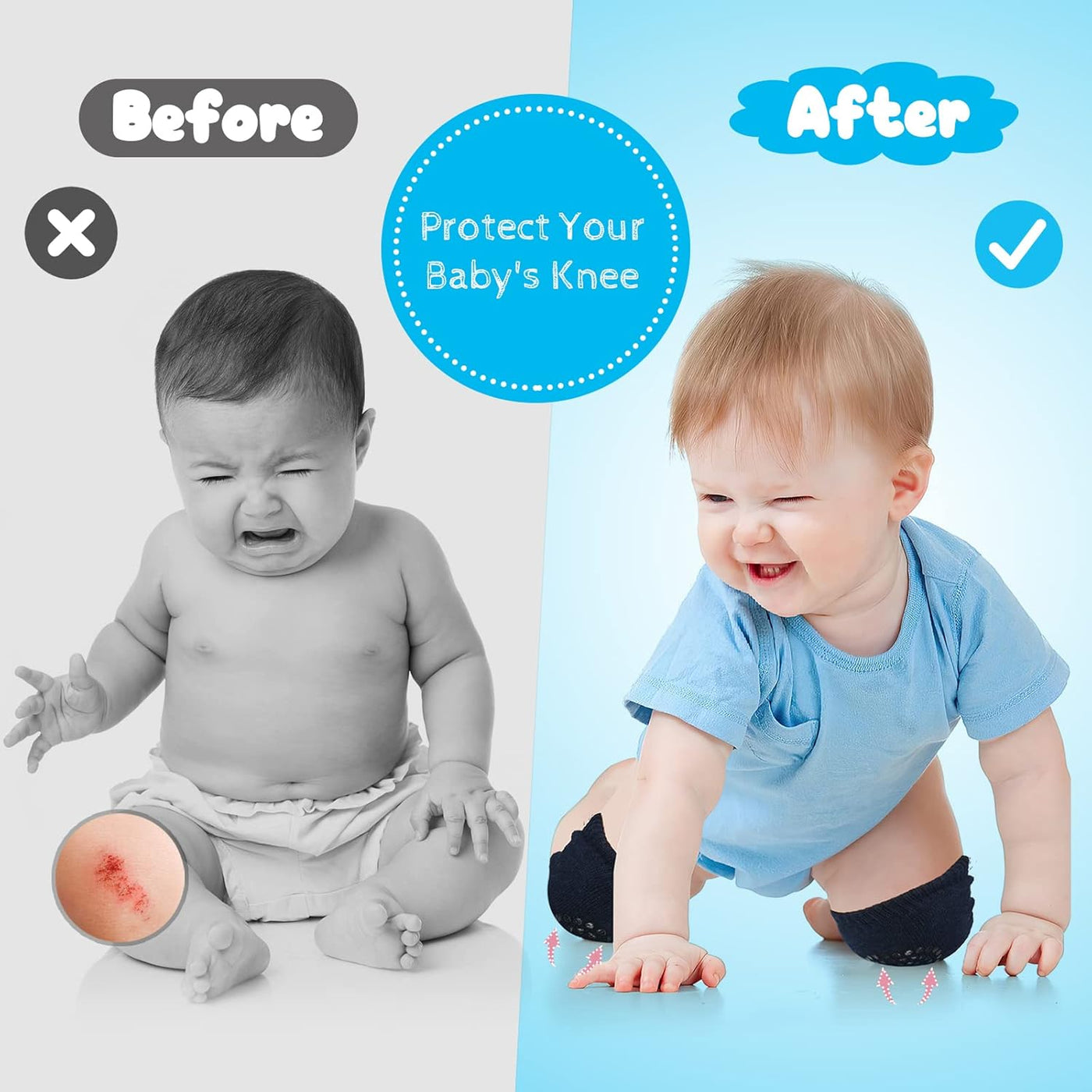 Baby Knee & Elbow Pads – Anti-Slip, Soft & Comfy