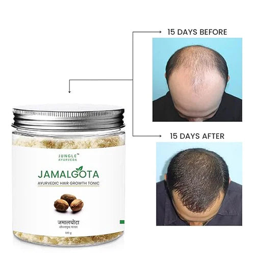 Jamalgota™ - Ayurvedic Hair Powder 🌱 (Buy 1 Get 1 Free🔥)